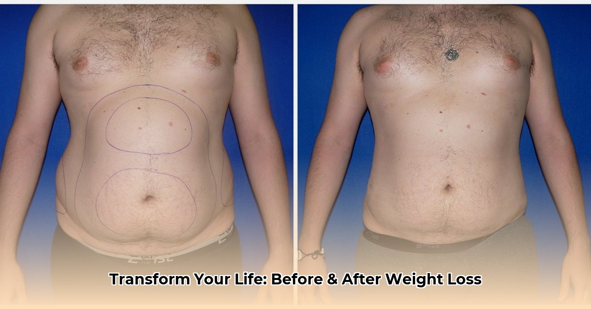 before-and-after-weight-loss-surgery-photos